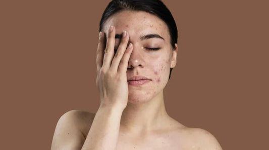 10 Most Common Skin Concerns